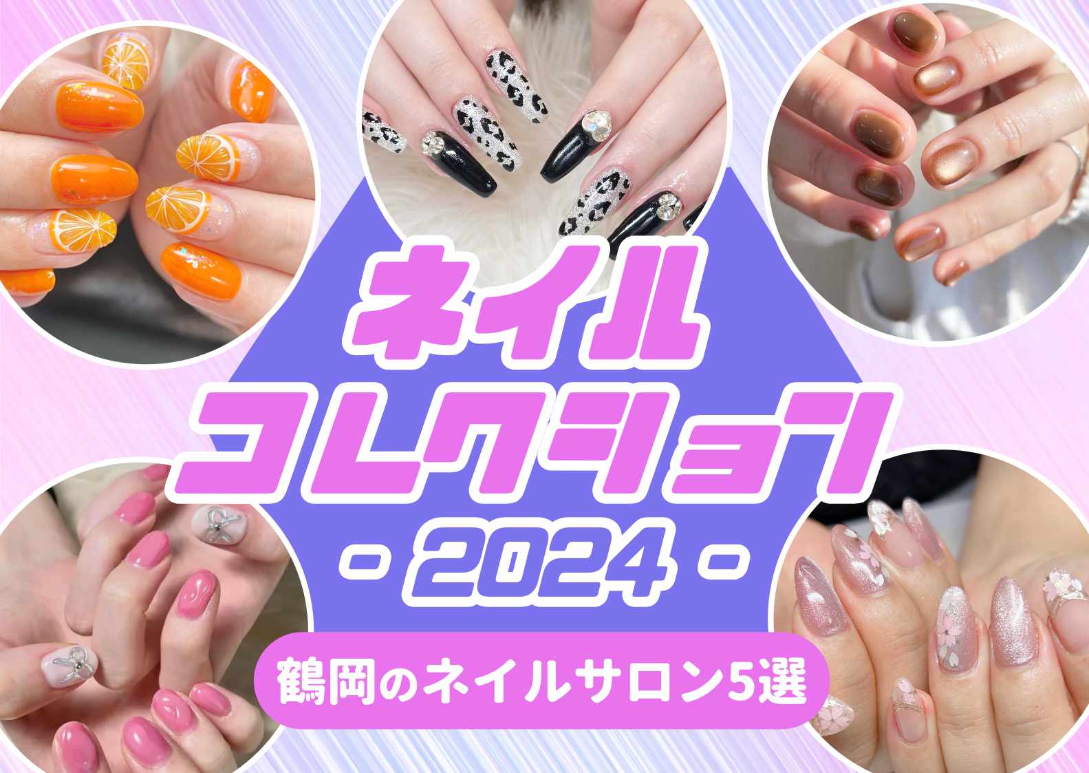 ◾️ BSブレイス ◾️ 巻き爪矯正 可愛らしかっ ネイルサロン